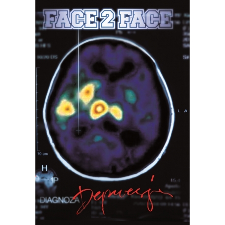 Face 2 Face - Depresja MC (PREORDER)